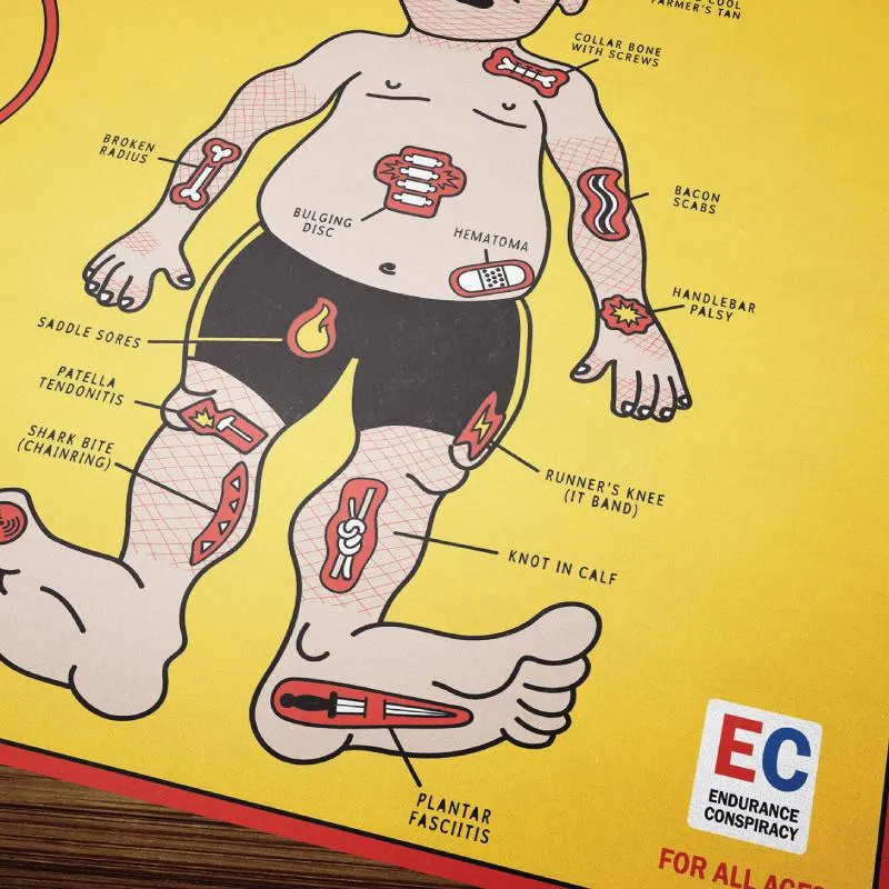 Operation - The Cycling Edition Poster